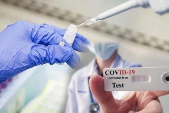 Фотография к новости: Елордада ПТР тест кімдерге тегін жасалады?