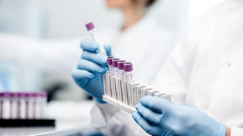 Фотография к новости: Сайлауды жазатын БАҚ өкілдері ПТР тапсырмайды – Бекшин 