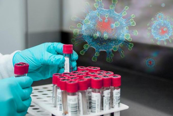 Фотография к новости: Коронавирустың жаңа штаммы әлемдік экономикаға қалай әсер етті?