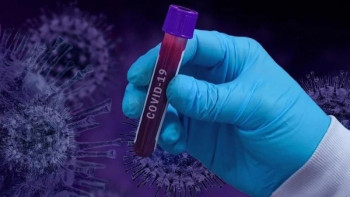 Фотография к новости: Коронавирустың жүйке жүйесіне әсері бар 