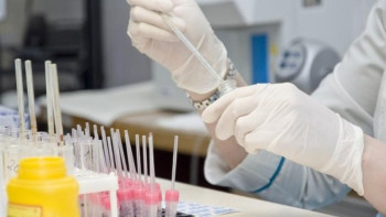 Фотография к новости: Соңғы екі айдағы көрсеткіш: эпидемиологиялық жағдай төмендеп келеді