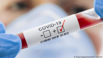 Фотография к новости: COVID-19 статистикасы алаңдаушылық тудыруда