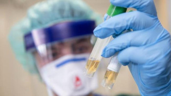 Фотография к новости: ﻿Елордада індет жұқтырғандар желтоқсан айымен салыстырғанда 35 пайызға өскен