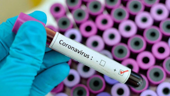 Фотография к новости: Елордада ауырғандардың негізгі үлесін 30-39 жастағы адамдар құрайды