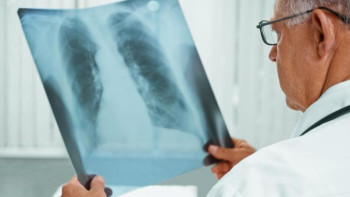 Фотография к новости: Қазақстанда туберкулезге шалдығу көрсеткіші 21%-ға төмендеді