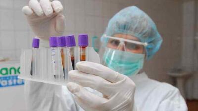 Биыл АИТВ-мен ауыратындарды антиретровирустық терапиямен қамту 73%  құрады – Шоранов  