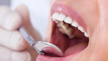 Фотография к новости: Әлемде 3,5 млрд адам ауыз қуысы ауруынан зардап шегеді