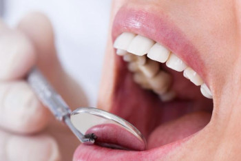 Фотография к новости: Әлемде 3,5 млрд адам ауыз қуысы ауруынан зардап шегеді