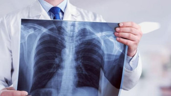 Фотография к новости: «Уақыт өтуде!»: Елордада туберкулезбен күрес айлығы жалғасып жатыр