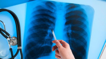 Фотография к новости: Елордада туберкулез ауруы бес есе азайды