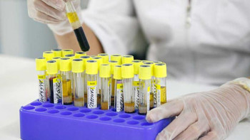 Фотография к новости: Жұқпалы ауруларға қатысты эпидахуал тұрақты ма?