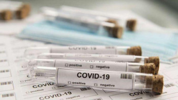 Фотография к новости: Туроператор пакетіне ПТР тесттің құны кірмек