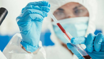 Фотография к новости: Антидене қалыптаспаған қазақстандықтар не істейді?