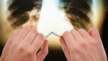 Фотография к новости: Шетелде шылым шегетін онкологты бірден лицензиясынан айырады - онколог