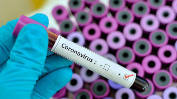 Фотография к новости: Алматыда соңғы айда 20 мың адамнан вирус анықталған