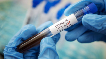 Фотография к новости: 11 мыңнан 8 мыңға төмендеді: Цой КВИ жұқтыру азайғанын айтты