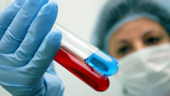 Фотография к новости: Жілік майының донорлығы денсаулық үшін қауіпті емес – дәрігер