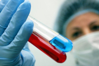 Фотография к новости: Жілік майының донорлығы денсаулық үшін қауіпті емес – дәрігер