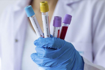 Фотография к новости: Коронавирустың бедеулікке әкелетіні ғылыми дәлелденген – иммунолог