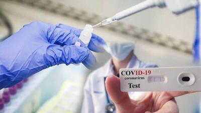 Вакцина алмаған азамат ПТР тестін апта сайын тапсырады