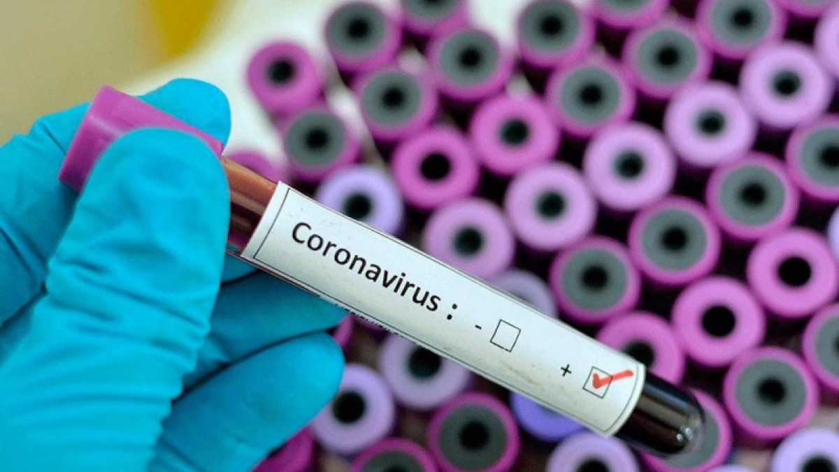 Елордада коронавирустың клиникалық сипаты өзгерген