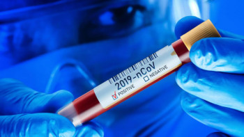 Фотография к новости: Елордада вирустың анықталуы 6 есеге көбейді – Көлгінов