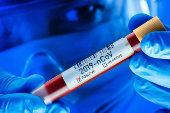 Фотография к новости: Елордада вирустың анықталуы 6 есеге көбейді – Көлгінов