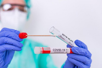 Фотография к новости: ПТР-сынамаларын тапсыру тегін бола ма?