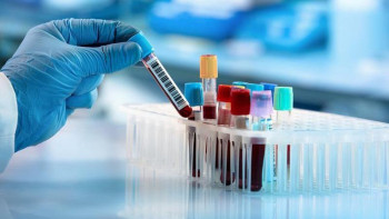 Фотография к новости: 2381 адам коронавирус инфекциясынан жазылып шықты