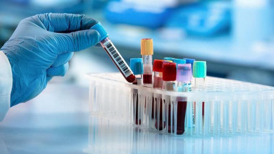 2381 адам коронавирус инфекциясынан жазылып шықты