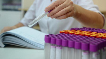 Фотография к новости: Вакцина салдырған соң коронавирус жұқтырғандардың үлесі 1-2% – дәрігер