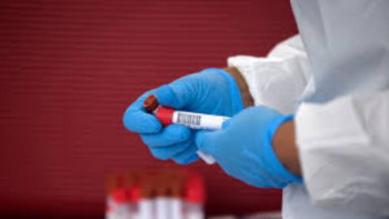 Фотография к новости: Инфекционист дәрігер коронавирусты үш рет жұқтырғандар туралы айтты