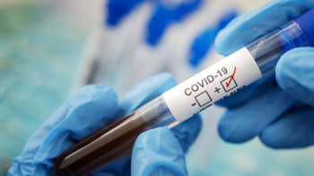 Фотография к новости: Әр адам өзгенің денсаулығы алдындағы әлеуметтік жауапкершілігін сезінуі керек – Төлеутаев