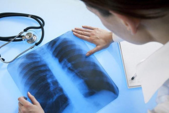 Фотография к новости: Алматыда аптасына 10 мыңнан астам адамнан вирус анықталып жатыр