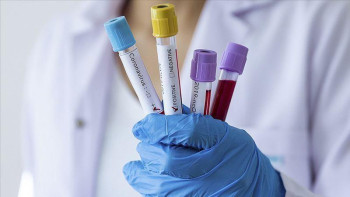 Фотография к новости: Алматыда жаңа туған нәресте коронавирустан көз жұмды