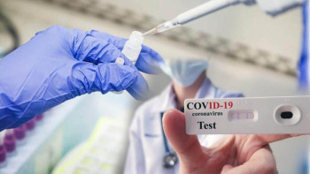 Фотография к новости: Студенттерден ПТР тестінің нәтижелерін талап етуге болмайды – БҒМ