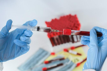 Фотография к новости: Қалада коронавирус жұқтырғандар саны төмендеп келеді – Пірәлиева