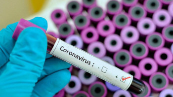 Фотография к новости: СOVID-19: Түркістан облысында 13 мыңнан астам адам коронавирусқа шалдыққан