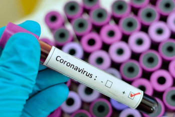 Фотография к новости: СOVID-19: Түркістан облысында 13 мыңнан астам адам коронавирусқа шалдыққан