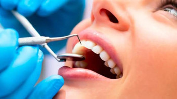 Фотография к новости: Кімдер тісін тегін емдете алады? 