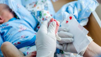 Фотография к новости: Неонаталдық скрининг деген не?