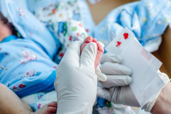 Фотография к новости: Неонаталдық скрининг деген не?