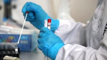 Фотография к новости: Жыл басынан бері 35 мыңға жуық шымкенттік коронавирус жұқтырған