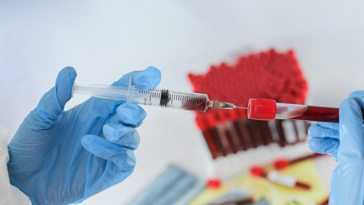 Вакцина алмағандар коронавирусты қайта жұқтыра береді – дәрігер