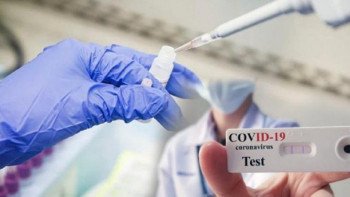 Фотография к новости: Қазақстан коронавирус инфекциясы бойынша «сары» аймақта