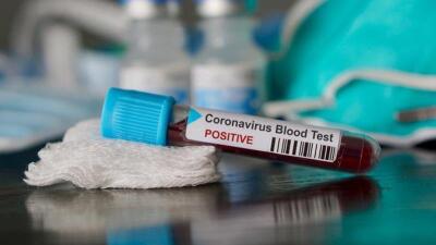 Өткен тәулікте коронавирус инфекциясын 1 900 адам жұқтырған 