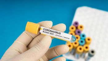 Фотография к новости: COVID-19: Әлемдегі эпидахуал қандай?