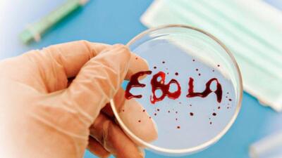Ұлыбританияда эбола вирусына қарсы жаңа вакцина сынақтан өткізіле бастады