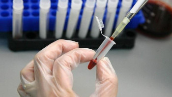 Фотография к новости: Ғасыр індеті – АИТВ қалай анықталады?