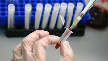 Фотография к новости: Қай облыс тұрғындары АИТВ дертін көп жұқтырады?